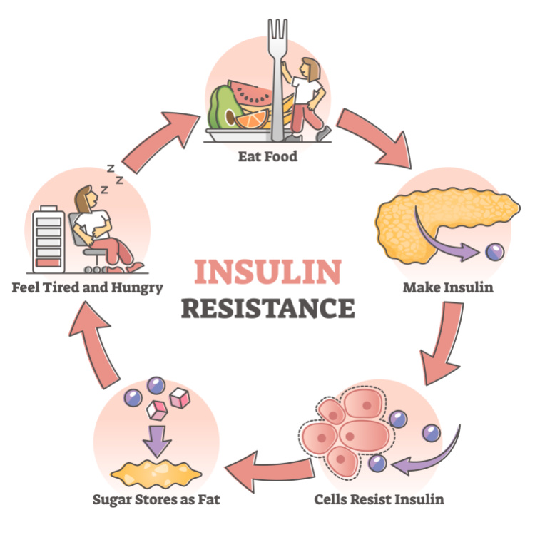 1 - Hormone Blog_Cravings_Insulin Resistance